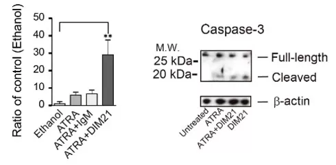 Bar chart quantifying Annexin V/PI–positive KG1 cells shows that anti-PtdGlc antibody (DIM21) increases apoptosis and synergizes with ATRA compared with controls (EtOH/IgM).